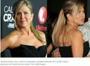 Jennifer Aniston aparece com manchas nas costas