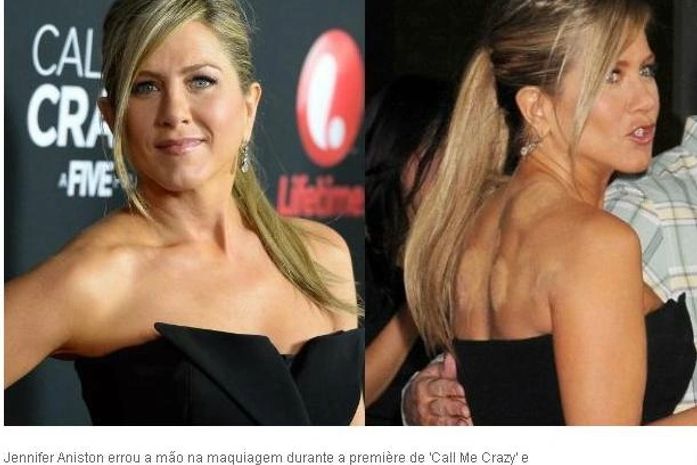 Jennifer Aniston aparece com manchas nas costas