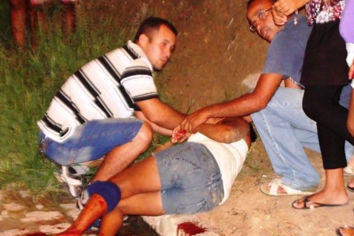 Mulher sofre atentado misterioso e fica ferida em Paripueira