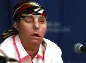 Americana com 80% do corpo queimado mostra nova face após transplante