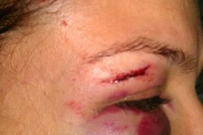 Após agressão, ex-mulher de cantor de dupla sertaneja pede proteção à polícia