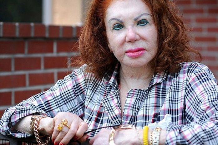 Aos 91 anos, mãe de Stallone mostra arrependimento por cirurgias plásticas