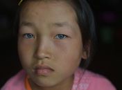 Chinesa enxerga normalmente, mas é surda e chamada de 'ET' pelas costas