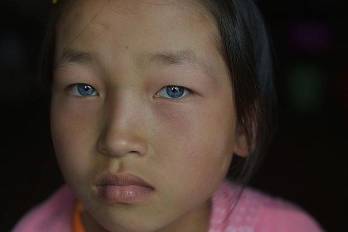 Chinesa enxerga normalmente, mas é surda e chamada de 'ET' pelas costas