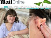 Condição rara faz mulher ouvir até o movimento dos olhos