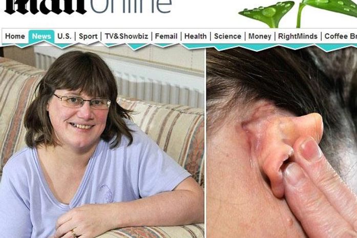 Condição rara faz mulher ouvir até o movimento dos olhos