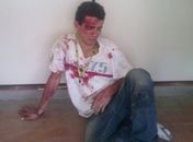 Jovem tenta atirar em "perueiro", arma falha e ele acaba espancado e preso por populares