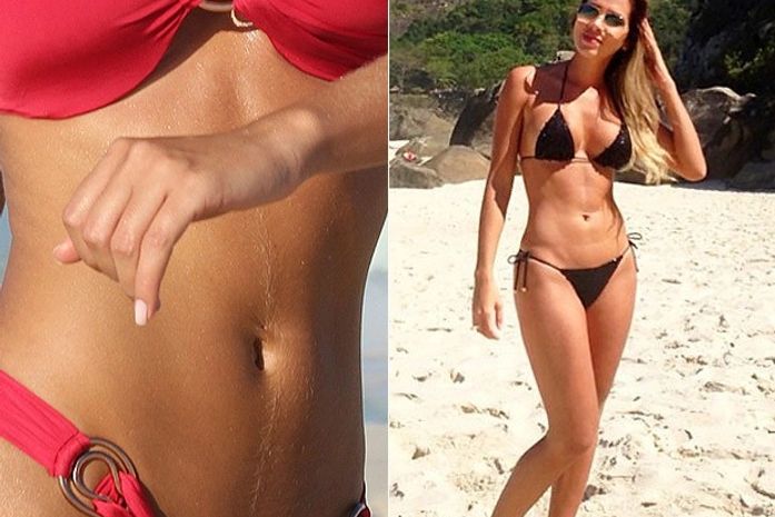 Sucesso nas redes sociais, ex-BBB Adriana conta segredos de depilação