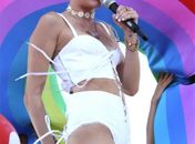 Miley Cyrus mostra mancha roxa na perna durante show