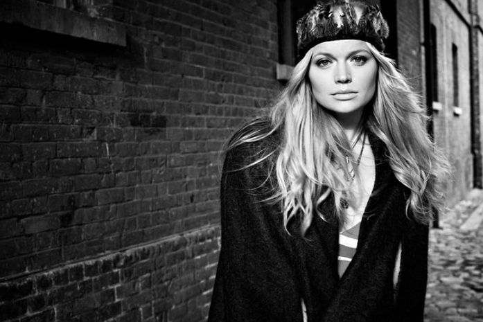 Modelo russa revela 'lado B' da moda e fala sobre dentes retirados para ter rosto fino