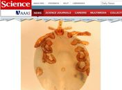 Cientista teria descoberto nova espécie de carrapato no próprio nariz