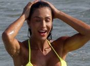 Gracyanne Barbosa faz tratamento com efeito lifting para o rosto que pode custar até R$ 7 mil