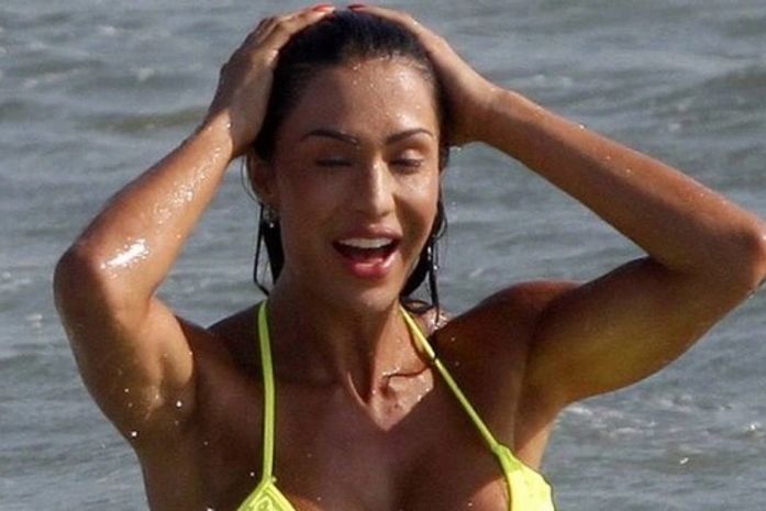 Gracyanne Barbosa faz tratamento com efeito lifting para o rosto que pode custar até R$ 7 mil