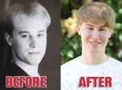 Homem de 33 anos gasta US$ 100 mil para ficar parecido com cantor Justin Bieber