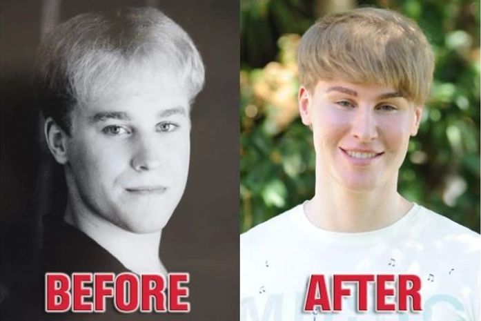 Homem de 33 anos gasta US$ 100 mil para ficar parecido com cantor Justin Bieber