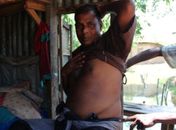 Pobres vendem órgãos para pagar dívidas em Bangladesh