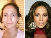 Médico posta fotos de  Jennifer Lopez antes e depois, mas cantora nega plástica