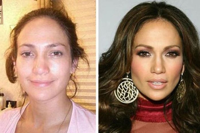Médico posta fotos de Jennifer Lopez antes e depois, mas cantora nega plástica