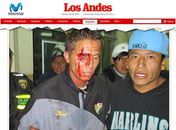 Técnico e jogador são agredidos por diretores após eliminação nos pênaltis