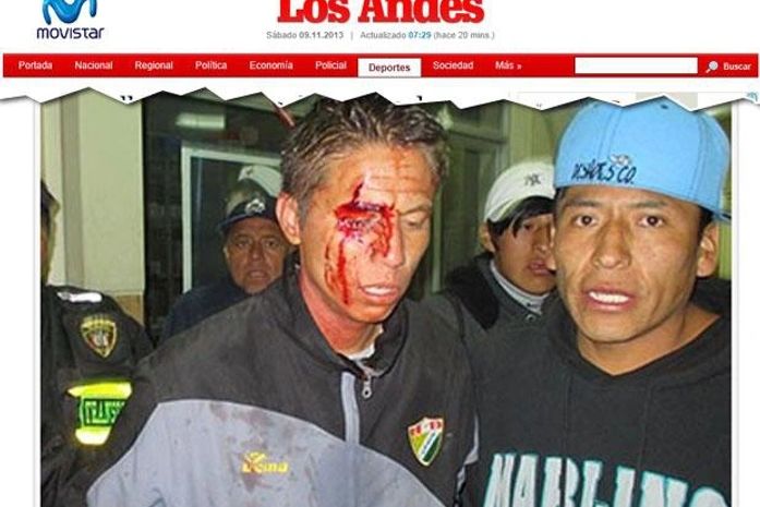 Técnico e jogador são agredidos por diretores após eliminação nos pênaltis