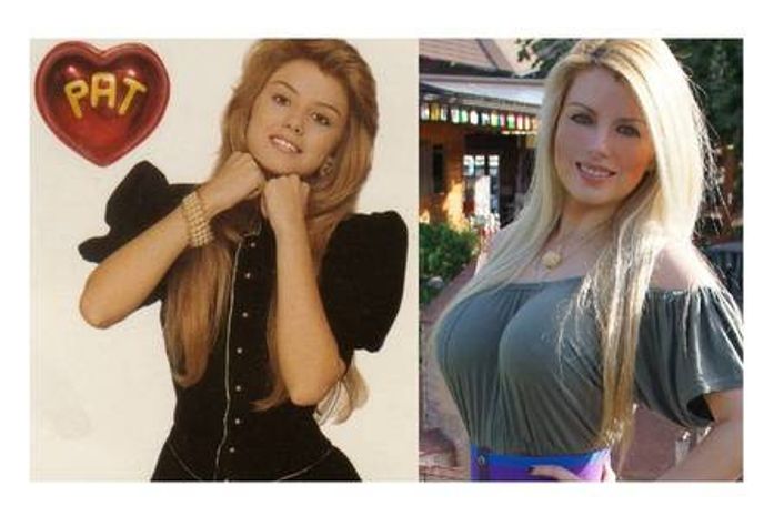 Ex-apresentadora infantil tem dor nas costas com seio maior que a cintura