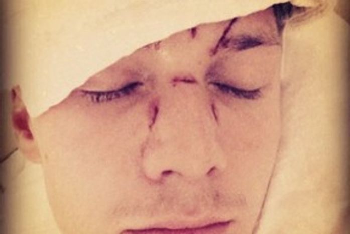 Irmão de Paris Hilton é chantageado com fotos comprometedoras, diz site