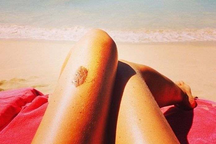 Angélica mostra as pernas, com pinta famosa, na praia: 'Relax'