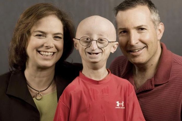 Com doença rara, americano morre aos 17 anos de "velhice"