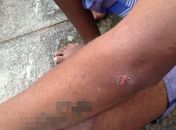 Adolescente mostra ferimento