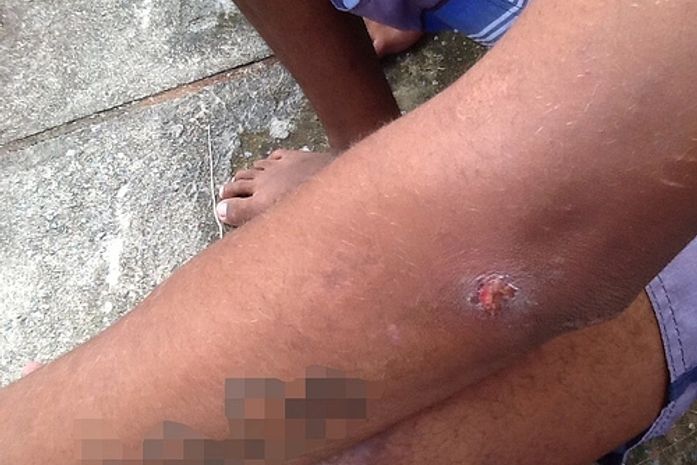 Adolescente mostra ferimento