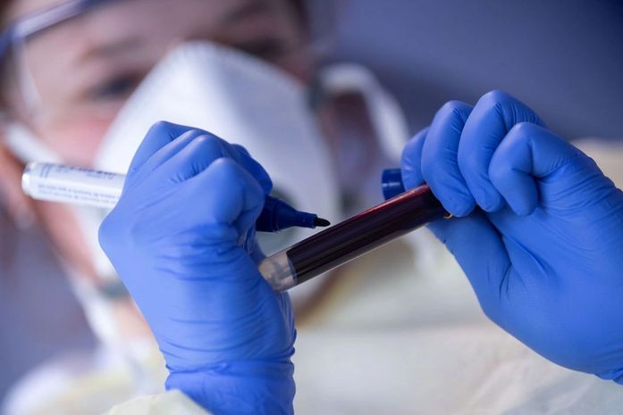 Covid-19: Alagoas tem 207.422 casos confirmados e 5.094 óbitos