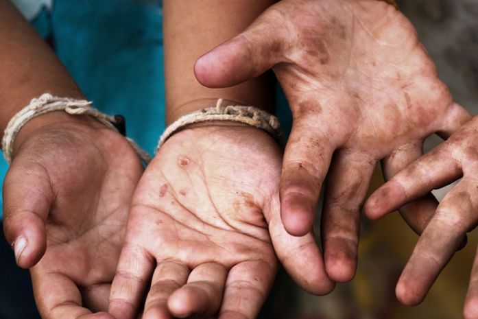 Atalaia assina acordo com MPT após ter 541 crianças em trabalho infantil e só 1 no CadÚnico