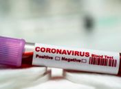 Coronavírus