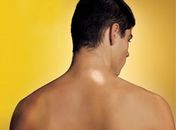 Campanha de prevenção à hanseníase acontece após a Copa