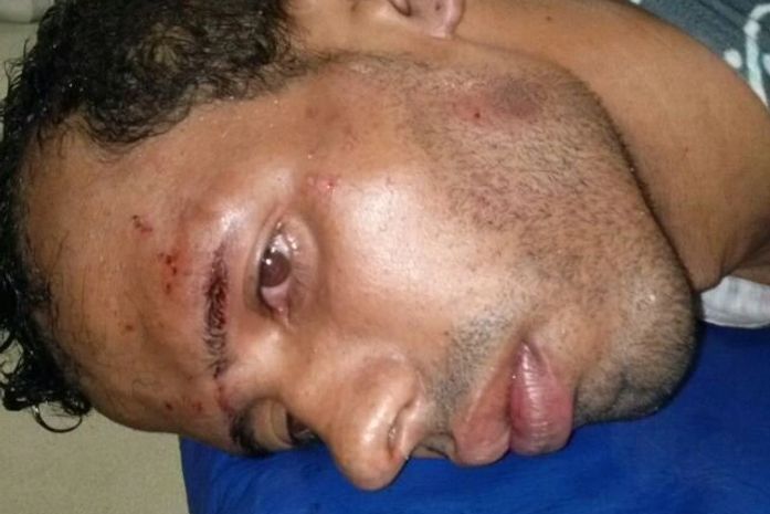 Assaltante é amarrado por mulheres após tentar roubar residência em Penedo