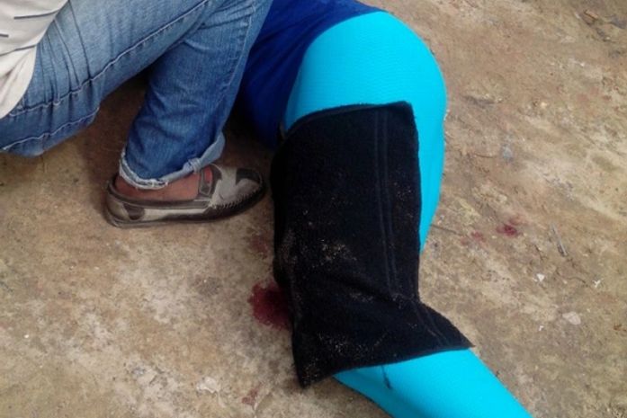 Mulher foi alvejada na perna