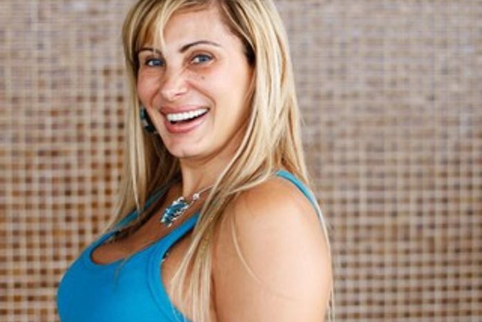 Modelo Ângela Bismarchi fala sobre plásticas: 'Se for preciso, faço mais'