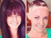 Após perder 80% do cabelo, mulher desabafa no Facebook