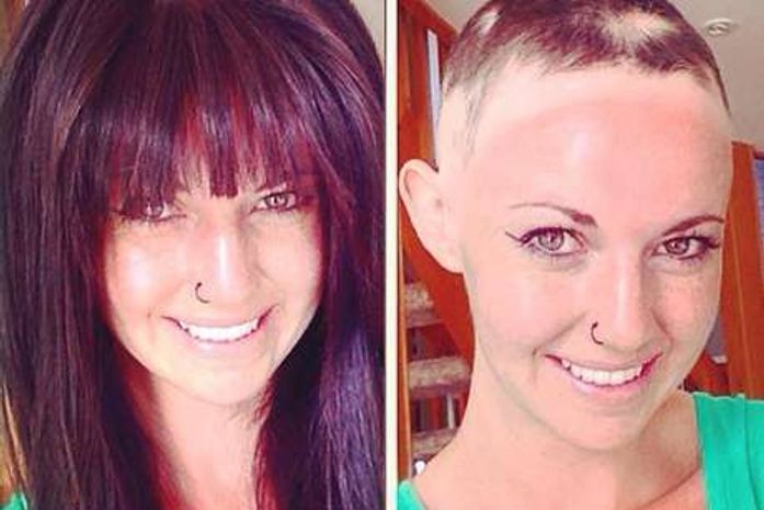 Após perder 80% do cabelo, mulher desabafa no Facebook