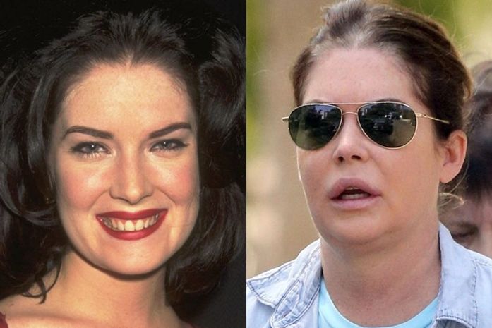 Aos 44, atriz aparece inchada e irreconhecível por excesso de plásticas; compare