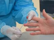 AL registra mais 614 novos casos de covid e 24 mortes; dos óbitos, 4 pessoas eram obesas
