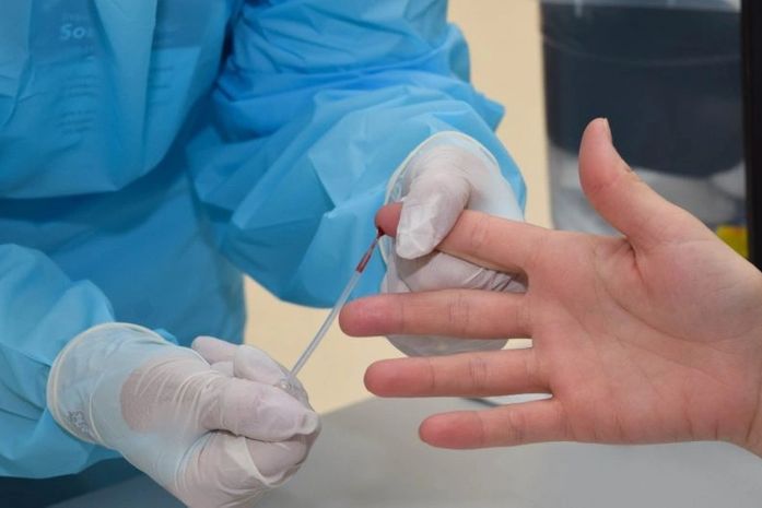 AL registra mais 614 novos casos de covid e 24 mortes; dos óbitos, 4 pessoas eram obesas