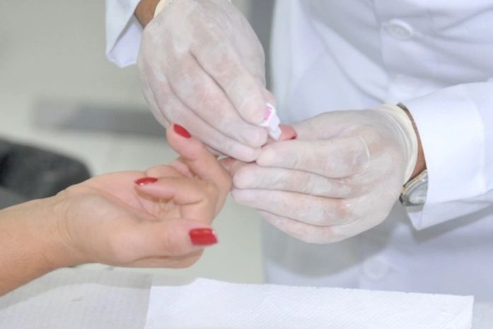 Infectologista do HM explica relação da Covid-19 em pacientes soropositivos
