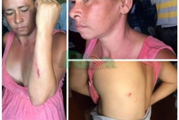 Mulher que matou marido diz que agiu para se defender