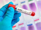 H1N1: Alagoas confirma 77 casos e registra sete óbitos