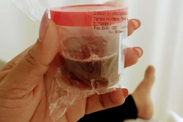 Duas pessoas são internadas com suspeita da doença da urina preta após consumir peixe