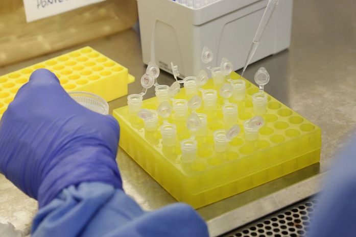 Cai para 11 o número de suspeitas de infecção por coronavírus no país