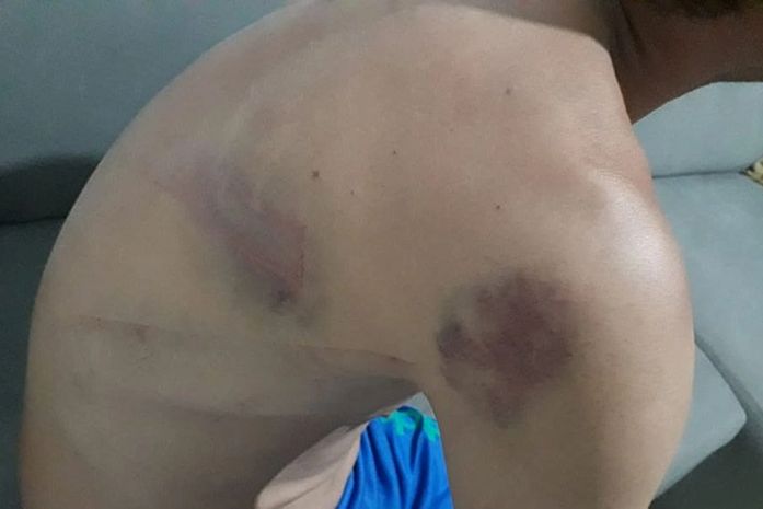 Grupo agrediu homem que tentou impedir que animal fosse morto.