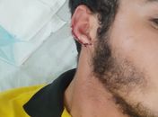 Jovem levou 10 pontos na orelha