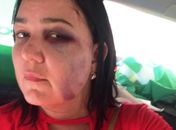Mulher denuncia agressão após declarar voto